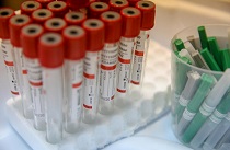 Рост заболеваемости остановят вакцинация и соблюдение санэпидрежима