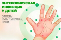 Роспотребнадзор напоминает о важности профилактики энтеровирусной инфекции